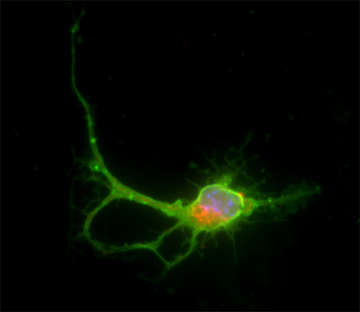neuron